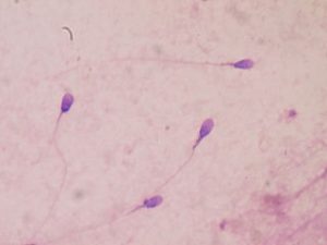 spermatozoides au microscope